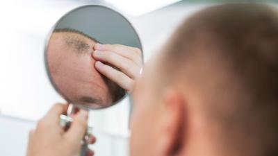 Hombre mirándose su calvicie en un espejo (Foto: Freepik)