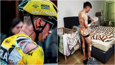 Roglic muestra sus heridas en las redes sociales (Fuente: primozroglic)