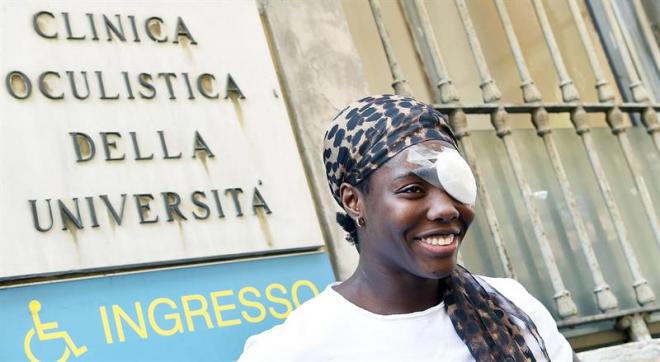 Daisy Osakue, con el ojo vendado tras una agresión racista.