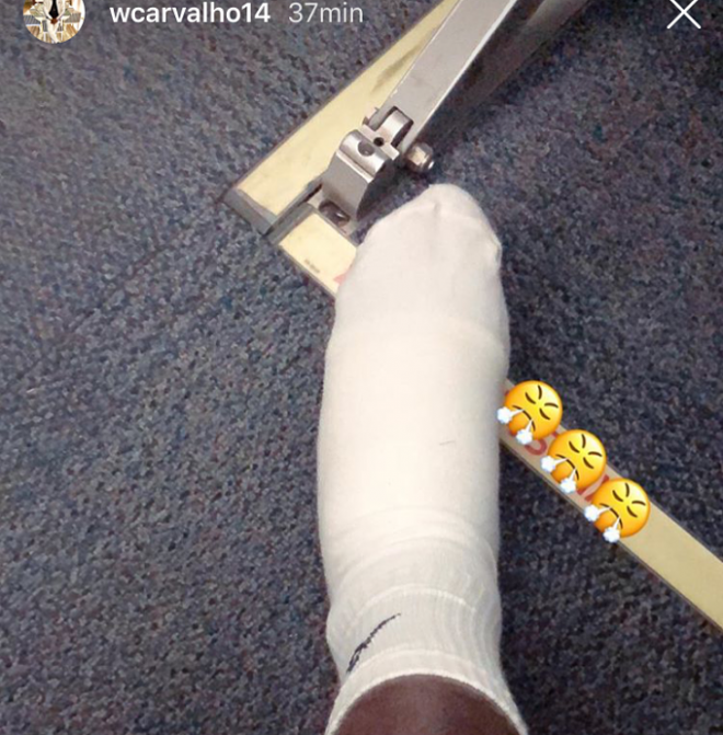 William Carvalho muestra en Instagram el estado de su tobillo tras el Alavés-Betis.