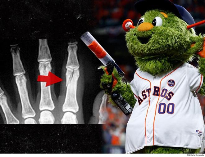 La radiografía del dedo de Jennifer y Orbit, mascota de los Houston Astros (Foto: TMZ).
