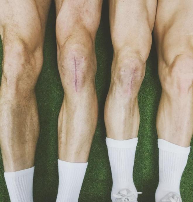 Las cicatrices en las rodillas de David López y Piatti.