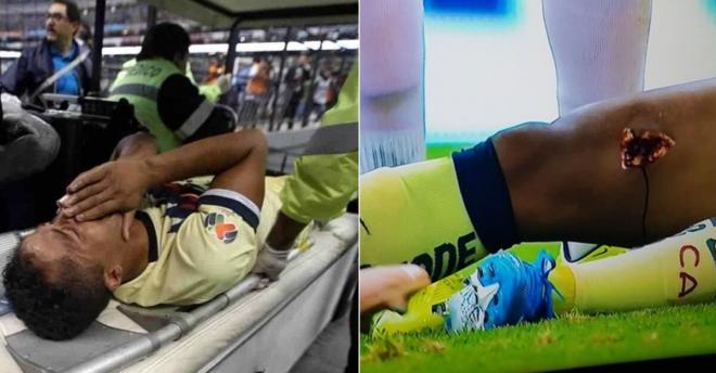 La dura lesión sufrida por Giovani dos Santos.
