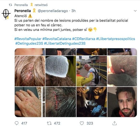 Confunden a Gameiro con un independentista herido por la Policía (Foto: Twitter)
