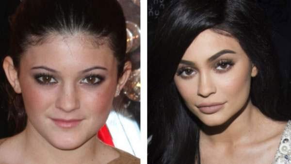 Kylie Jenner antes y después