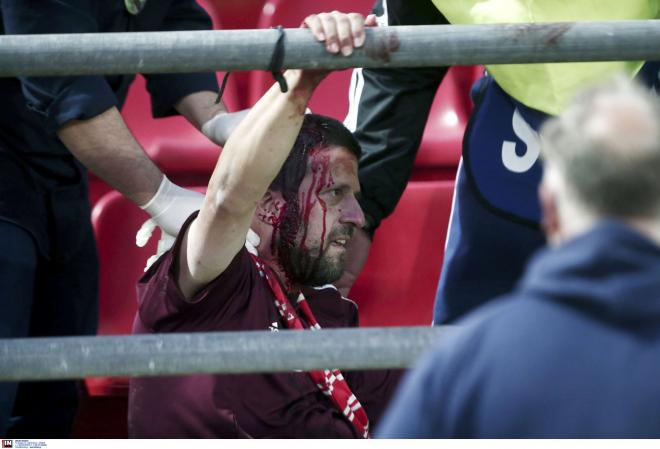 Un aficionado del Bayern con sangre en su rostro.