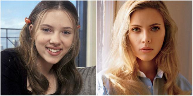 Scarlett Johansson, antes y después de sus operaciones.