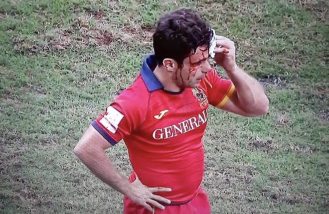 Paco Hernández, con la cara ensangrentada durante el partido de España de Rugby.