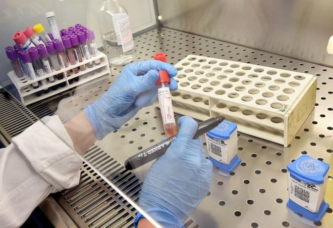 Tests para detectar el coronavirus (Foto: EFE)