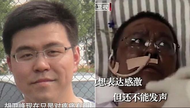 Hu Weifeng, uno de los médicos chinos de Wuhan que terminaron con la piel negra por el tratamiento del coronavirus.