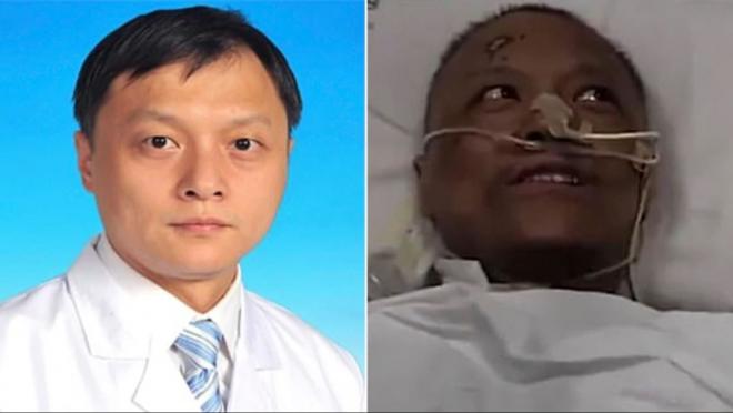 Yi Fan, uno de los médicos chinos que terminaron con la piel negra por el tratamiento del coronavi