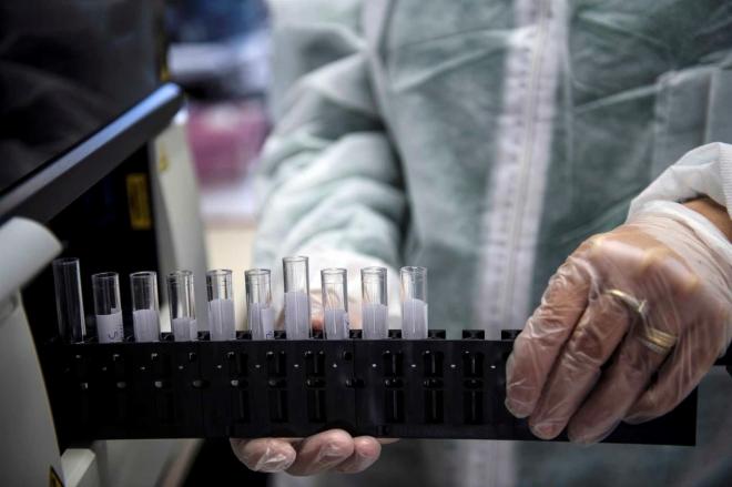 Diales de prueba de una vacuna (Foto: EFE/Julien de Rosa).