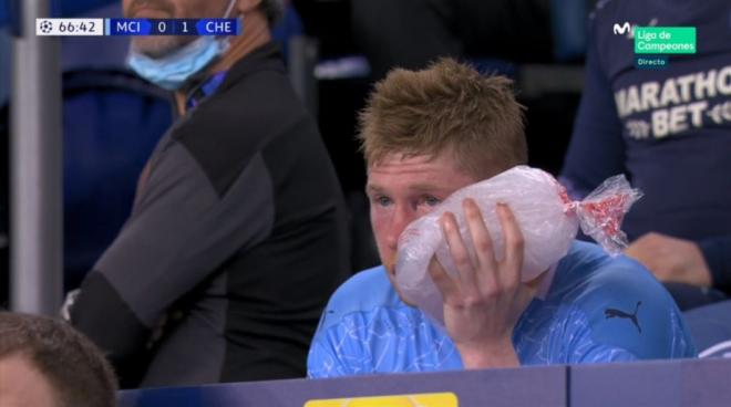 Kevin de Bruyne, con el ojo morado tras el choque con Rudiger en la final de Champions League.