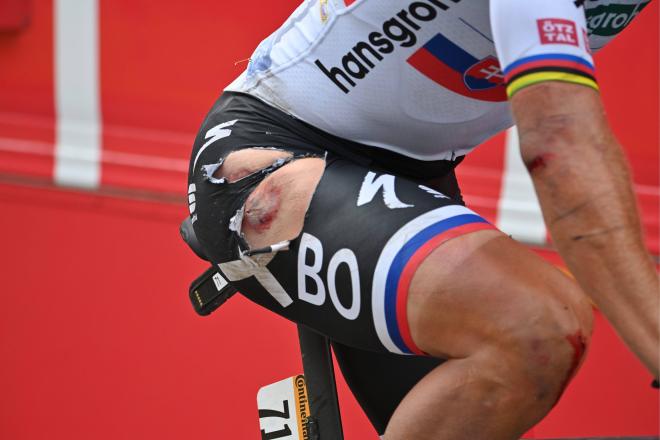 Herida de Peter Sagan tras su caída en el Tour de Francia (Foto: Cordon Press).