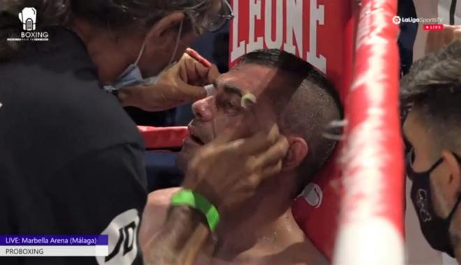 Andoni Gago atendido en la ceja durante la velada de boxeo de Marbella.