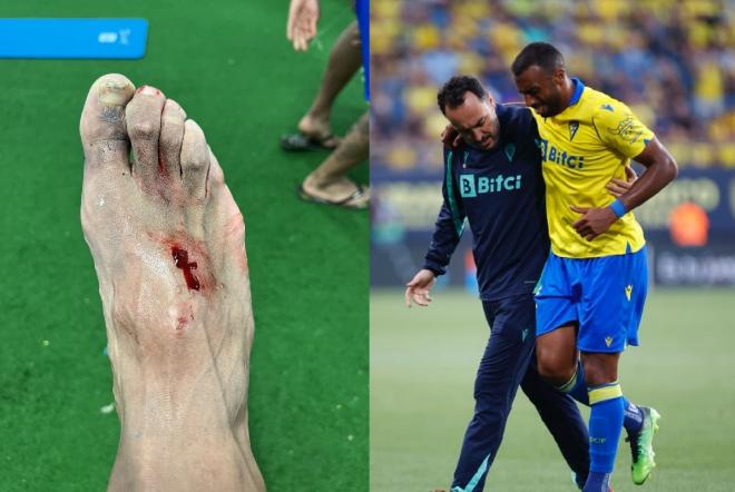 El pie de Carlos Akapo tras la entrada de Hazard.