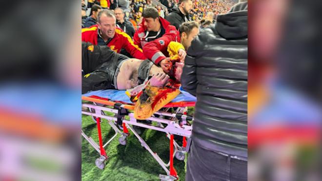 Violencia: el aficionado turco herido por la bengala durante el partido de fútbol.