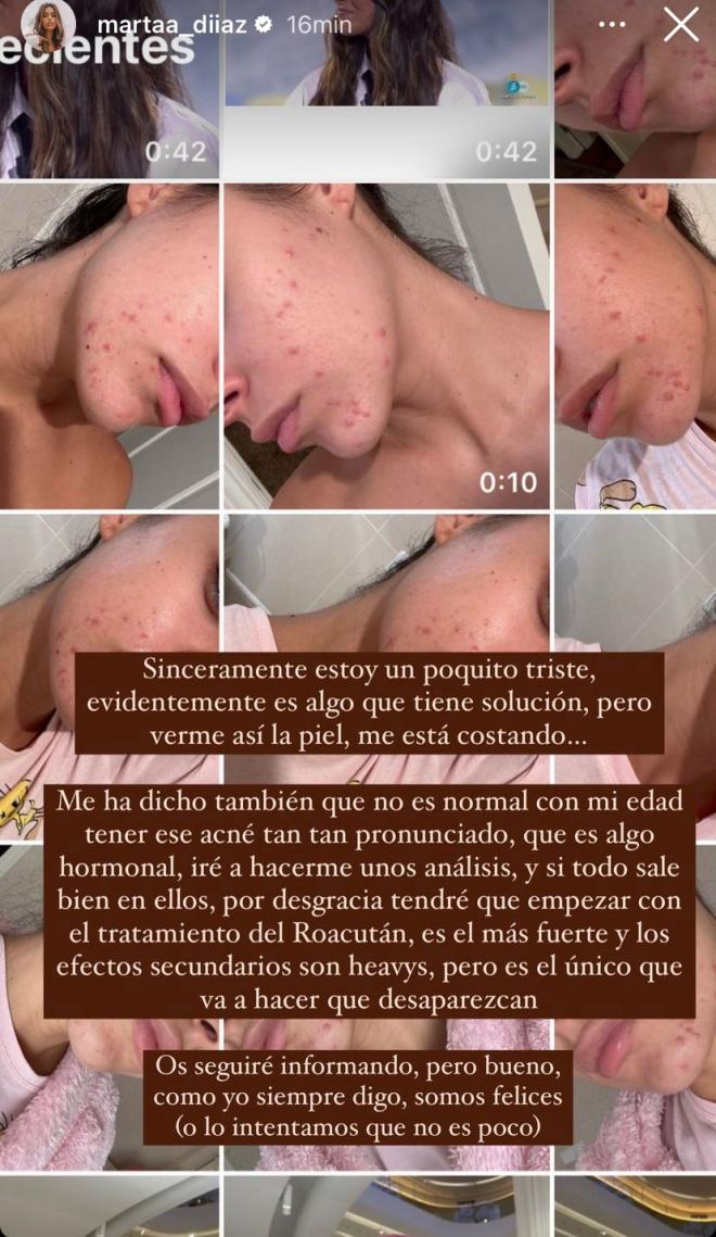 Marta Díaz se sincera acerca de su problema de acné (@martaa_diiaz)