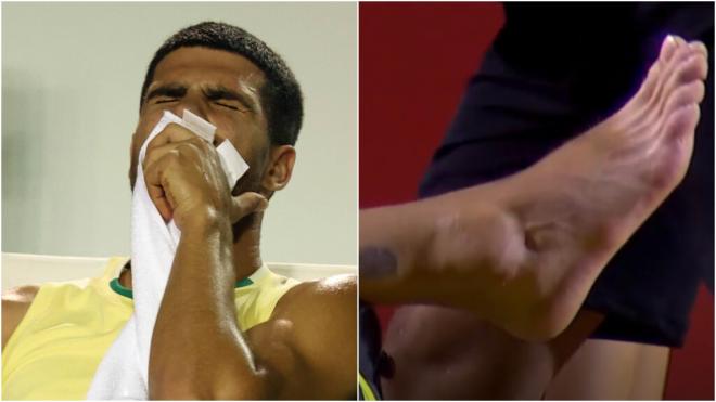 Así acabó el tobillo de Carlos Alcaraz tras el partido en Río. (Fuente: Cordon Press)