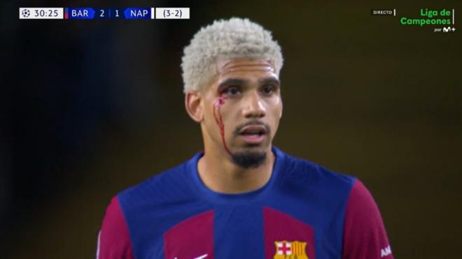 La herida de Ronald Araujo en el Barça - Nápoles (Captura de la retransmisión de Movistar +)