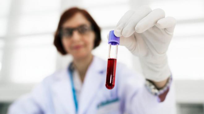 Profesional sanitario analizando una analítica de sangre