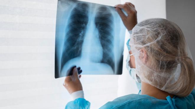 Profesional sanitario revisando una radiografía de pulmón
