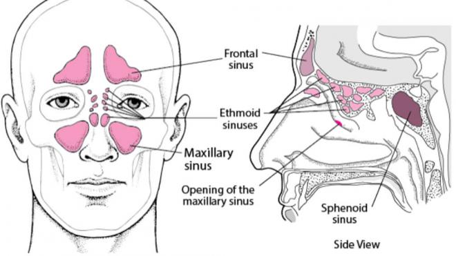 Ubicación de los senos paranasales, vista de frente y de perfil (Manual MSD)