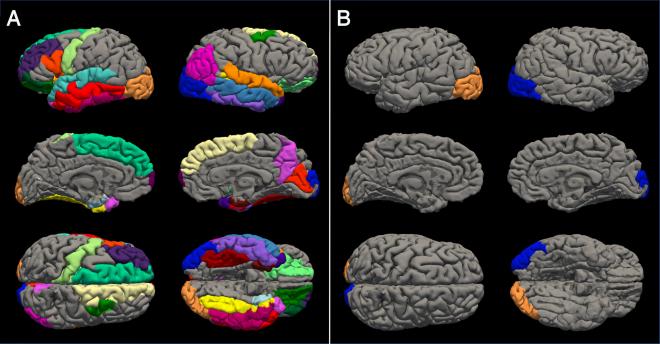 Regiones con un adelgazamiento cortical significativamente acelerado en el cerebro de adolescentes después del confinamiento por COVID-19. A (mujeres) y B (hombres) (Foto: PNAS)