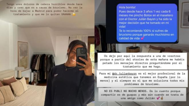 Ana Peleteiro habla del bruxismo que sufre en Instagram (@apeleteirob)