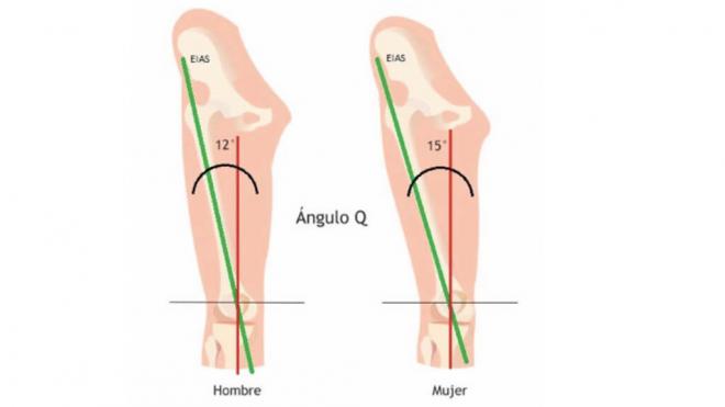 Representación gráfica del ángulo Q (Foto: Resport Clinic)