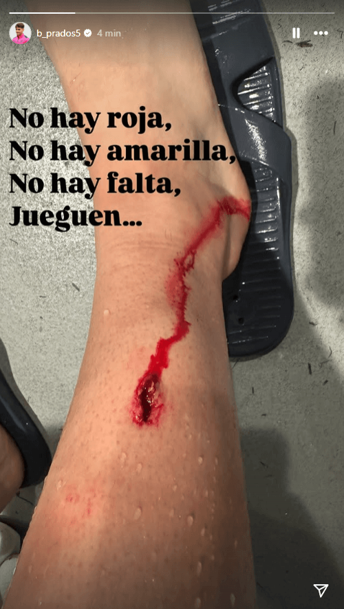Herida de Beñat Prados en su pierna tras la entrada de Lindelof (Foto: Instagram).