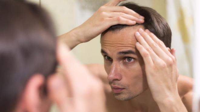 Hombre mirándose al espejo las entradas (Foto: Freepik)