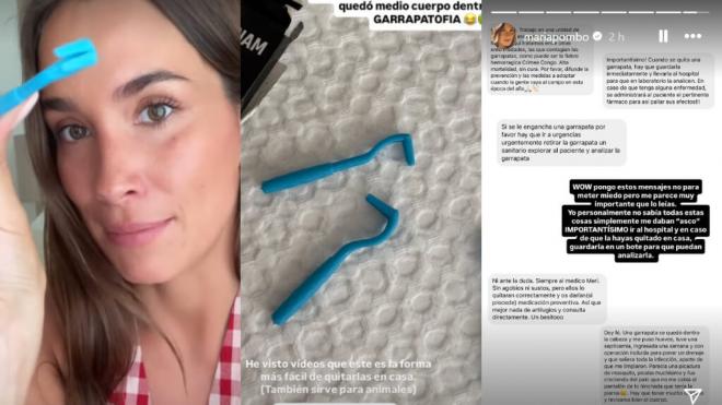 María Pombo, alerta sobre las picaduras de las garrapatas (Foto: @mariapombo)