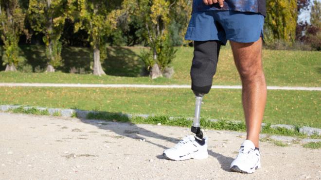 Piernas de un hombre con una de ellas amputada y con prótesis (Foto: Freepik)