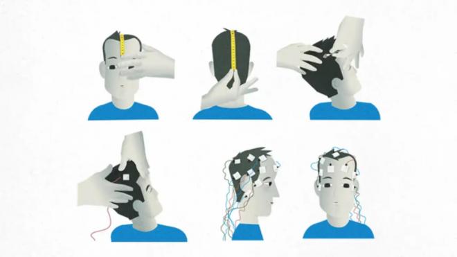 Colocación de los electrodos para realizar un electroencefalograma (Foto: Hospital Clínic Barcelona)