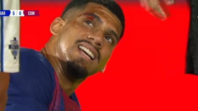 Ronald Araújo sufrió una herida tras golpearse la cabeza con Nico Paz (FCB YT).