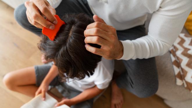Familiar con una lendrera revisando la cabeza de un niño (Foto: Freepik)