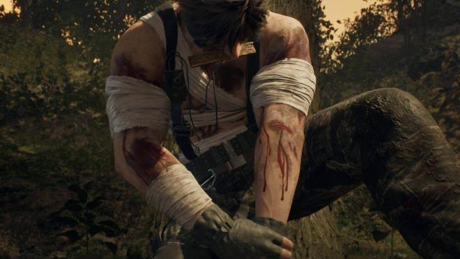 El sistema de heridas permanentes, una de las novedades de Metal Gear Solid Delta