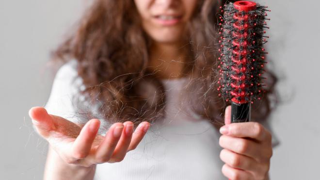 Mujer con caída de pelo (Foto: Freepik)