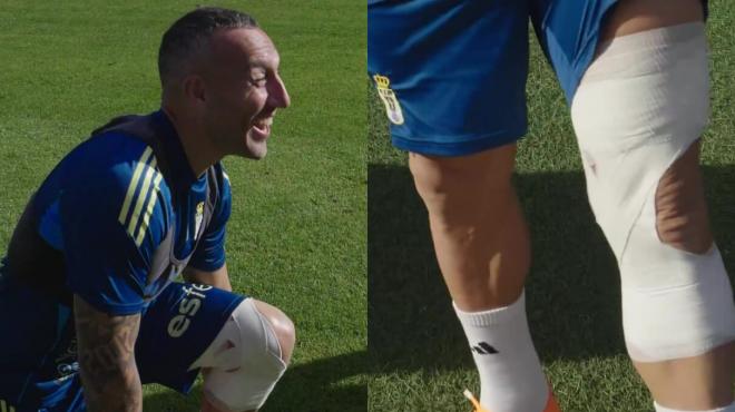 El vendaje de Santi Cazorla (Imagenes: Real Oviedo).