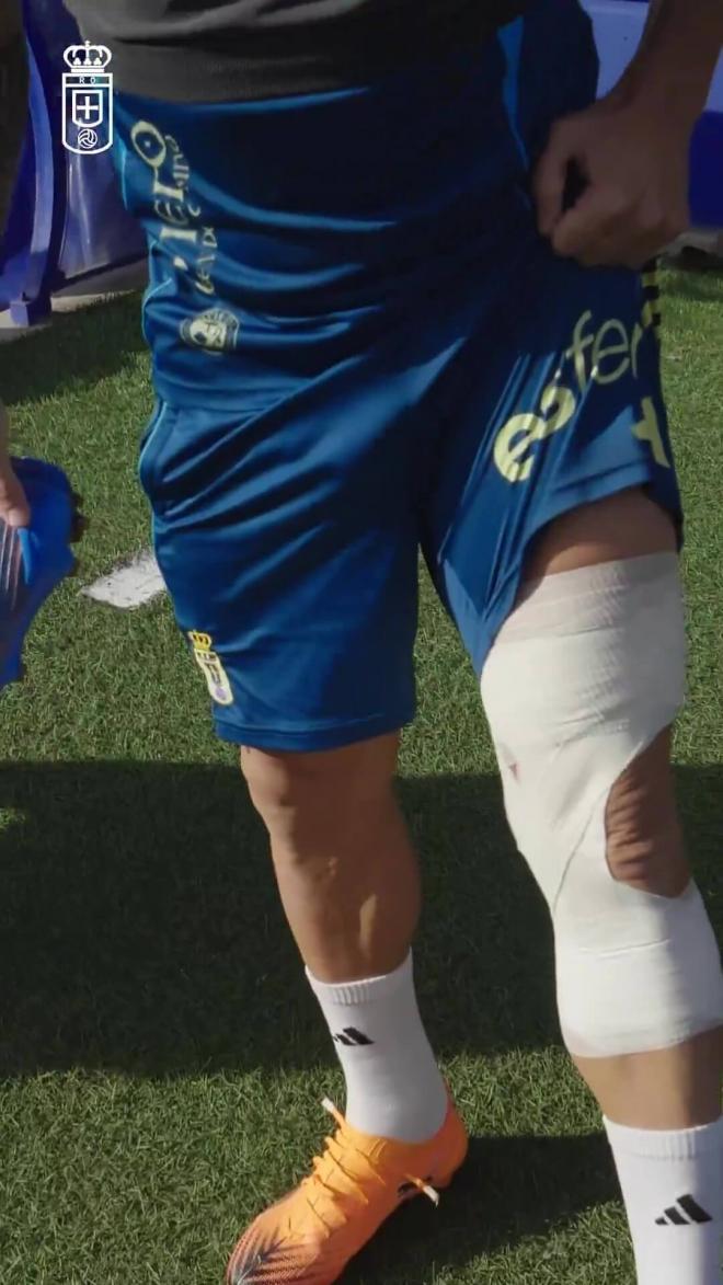 Santi Cazorla enseña su vendaje (Imagen: Real Oviedo).