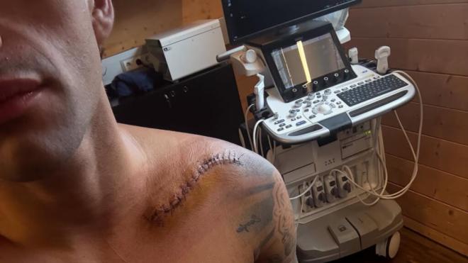 Jorge Martín, durante su recuperación (Foto: @89jorgemartin).