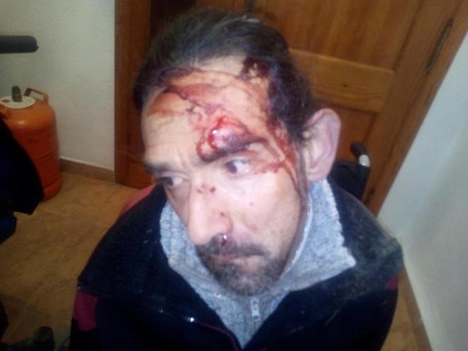 El atleta paralímpico Enrique Marí fue agredido en Valencia el pasado mes de enero. (Foto: Facebook Javier Marí)