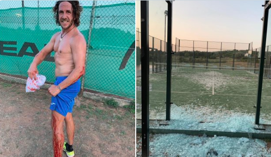 Carles Puyol rompe un cristal jugando al pádel y acaba lleno de sangre (Fotos: @carles5puyol).